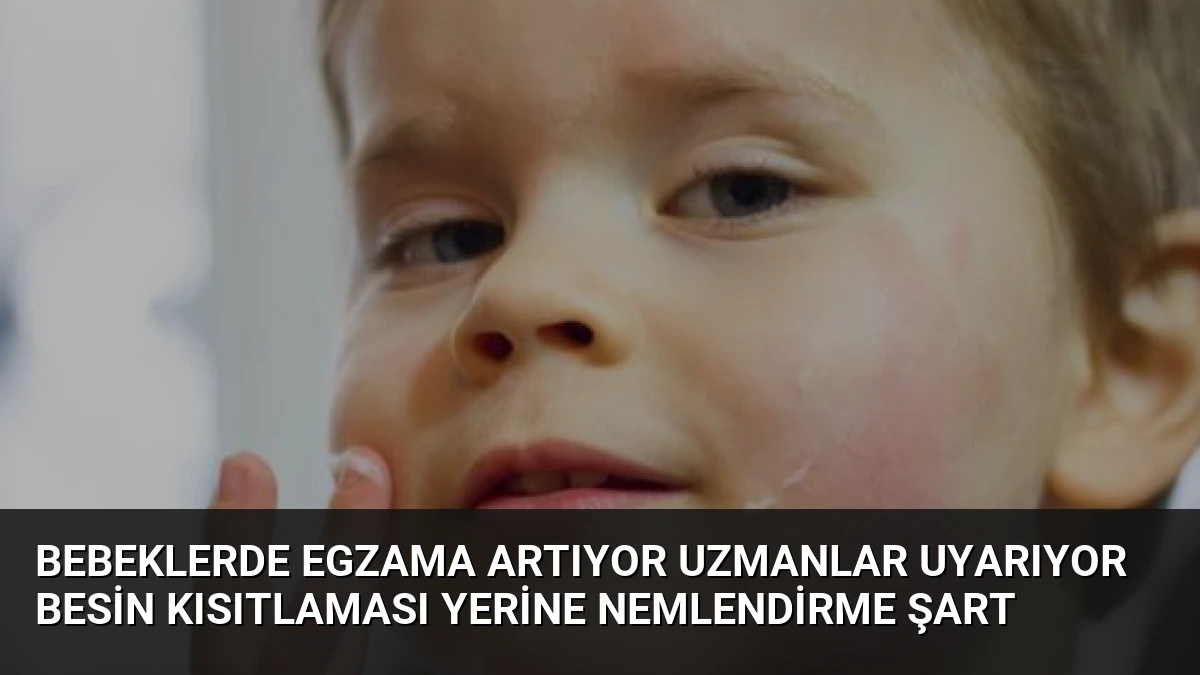 Bebeklerde Egzama Artıyor Uzmanlar Uyarıyor Besin Kısıtlaması Yerine Nemlendirme Şart