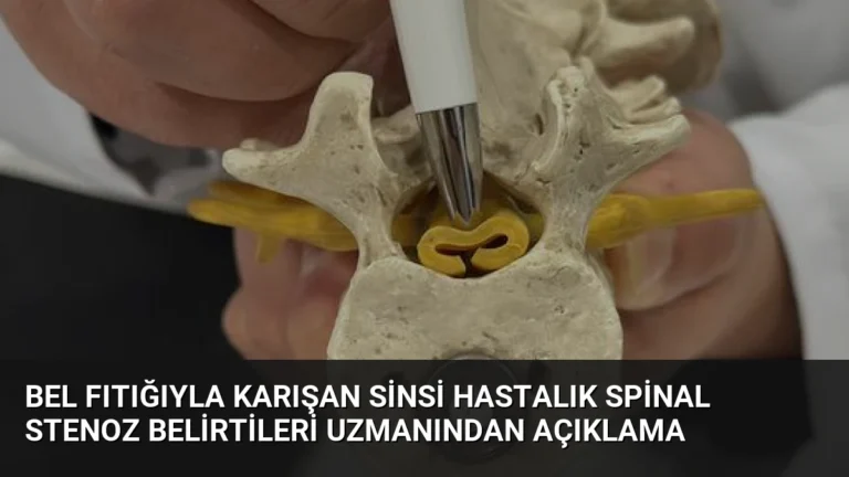 Bel Fıtığıyla Karışan Sinsi Hastalık Spinal Stenoz Belirtileri Uzmanından Açıklama