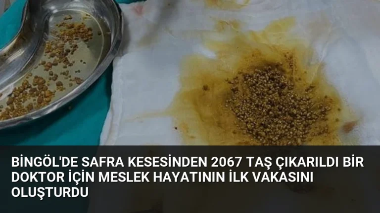 Bingöl’de Safra Kesesinden 2067 Taş Çıkarıldı Bir Doktor İçin Meslek Hayatının İlk Vakasını Oluşturdu