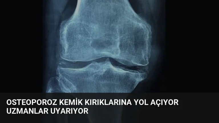 Osteoporoz Kemik Kırıklarına Yol Açıyor Uzmanlar Uyarıyor