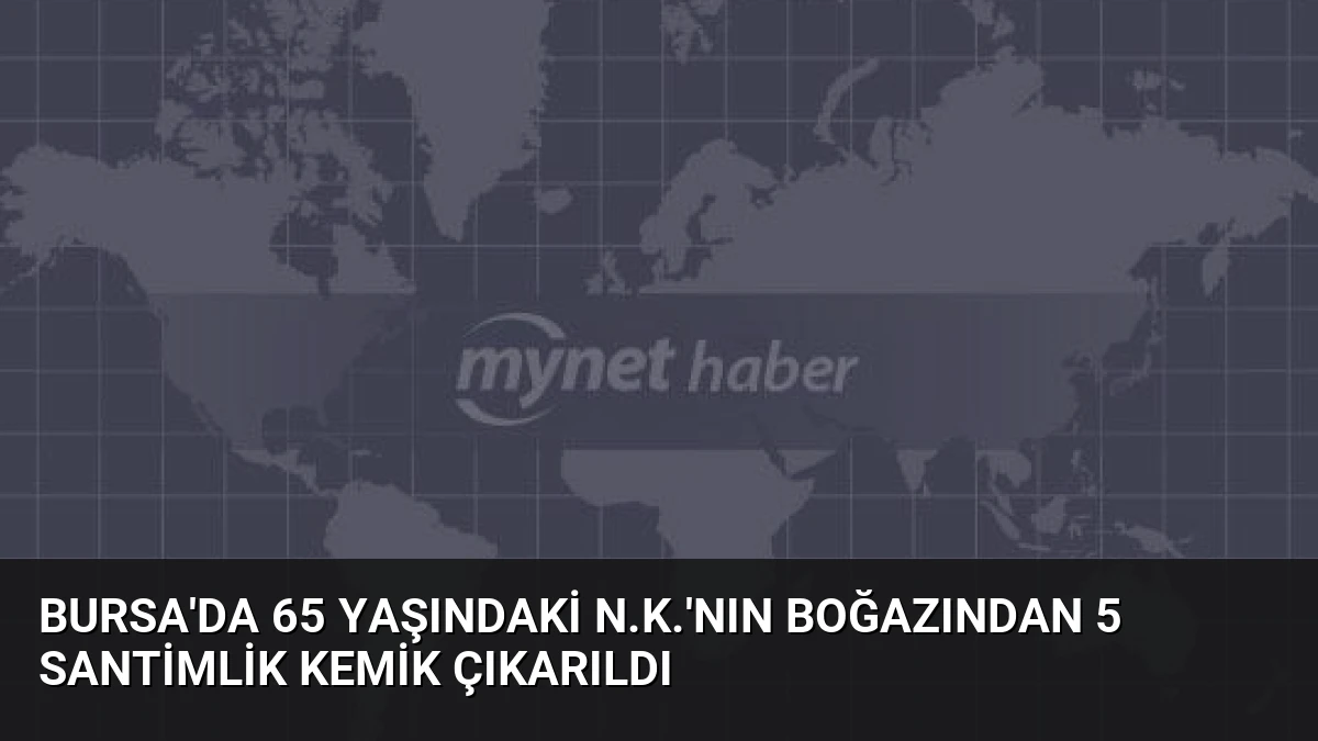 Bursa’da 65 Yaşındaki N.K.’nın Boğazından 5 Santimlik Kemik Çıkarıldı
